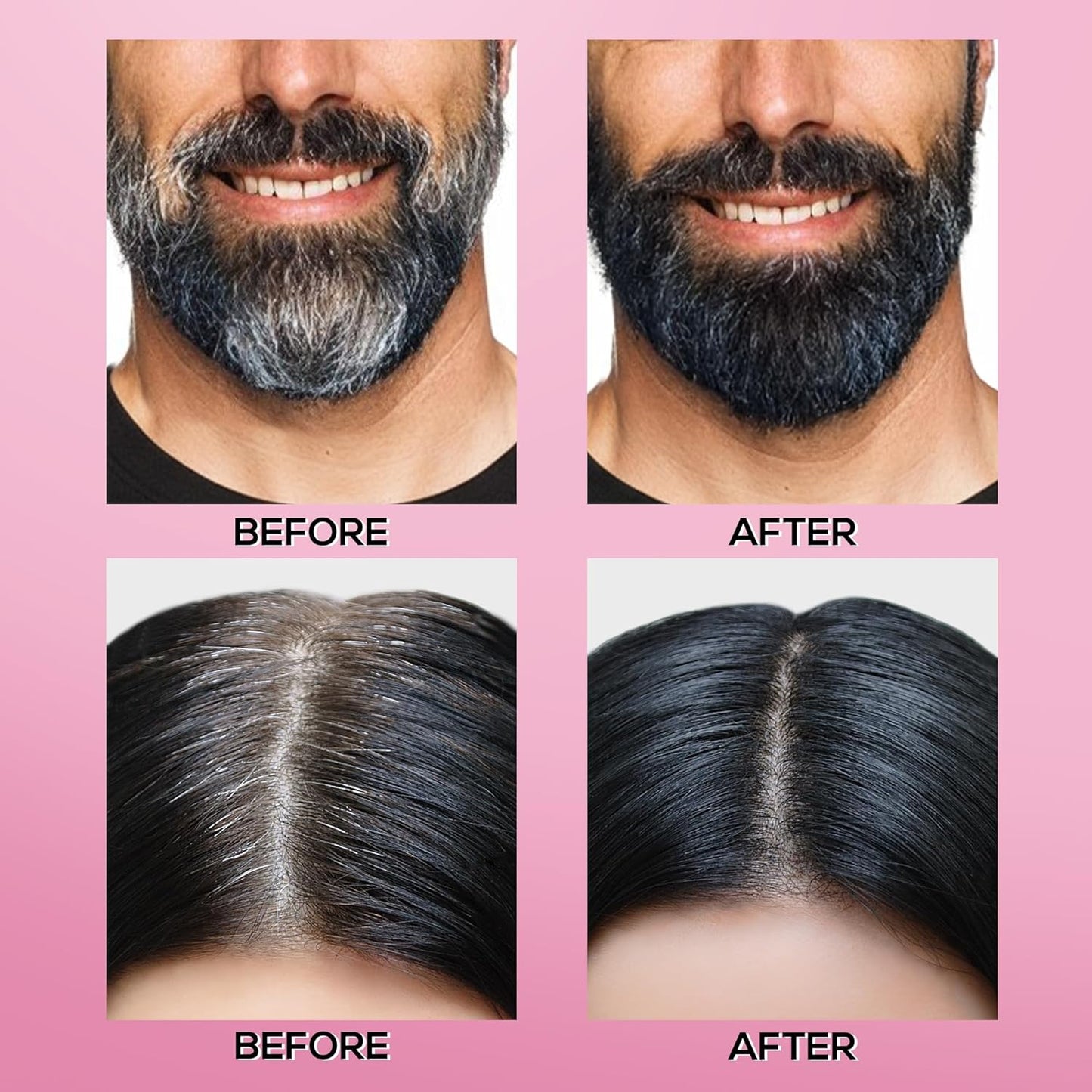 RENEE Cover-Up Hair Powder - Black | Covers Grey Roots & Bald Spots Instantly | Highly Pigmented, Fuller & Denser Look | Long-Lasting | Matte Finish | Fine Powder | Flawless Application | 4gm